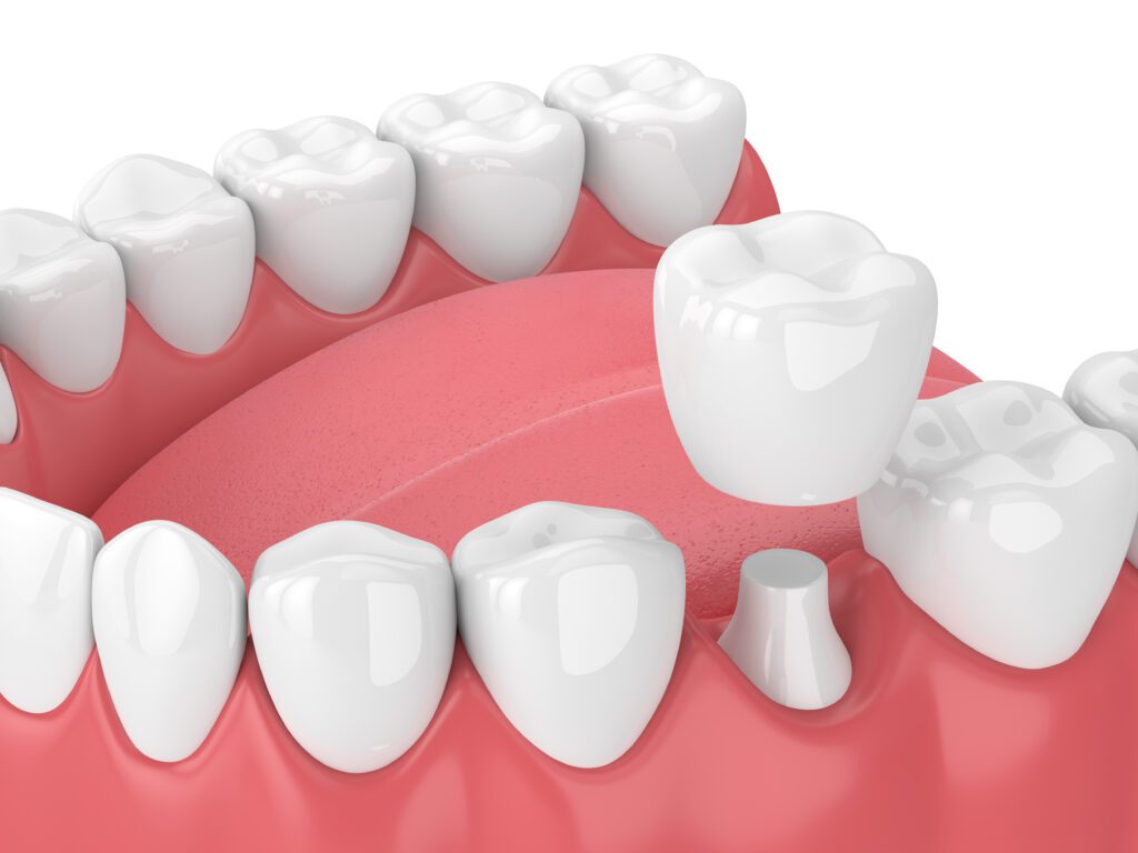 Dentist in Plainfield