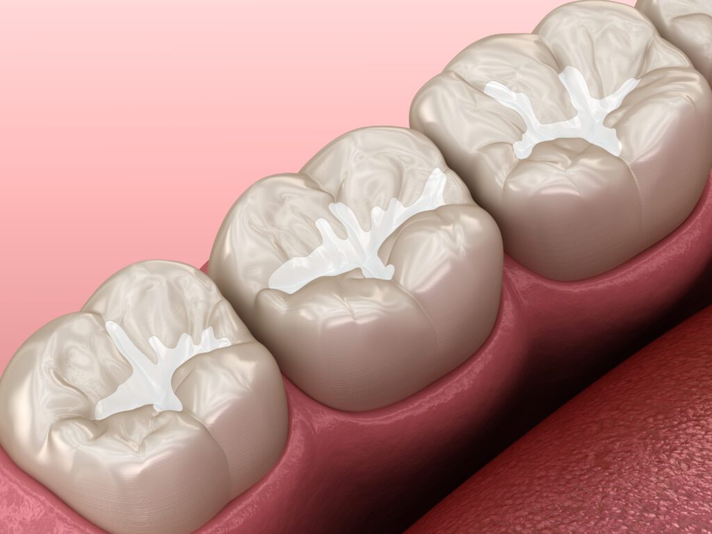 Dentist in Plainfield