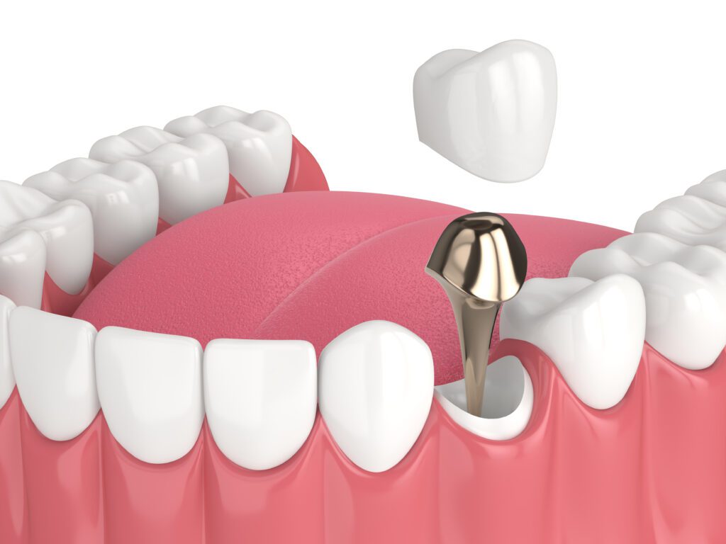 Dentist in Plainfield