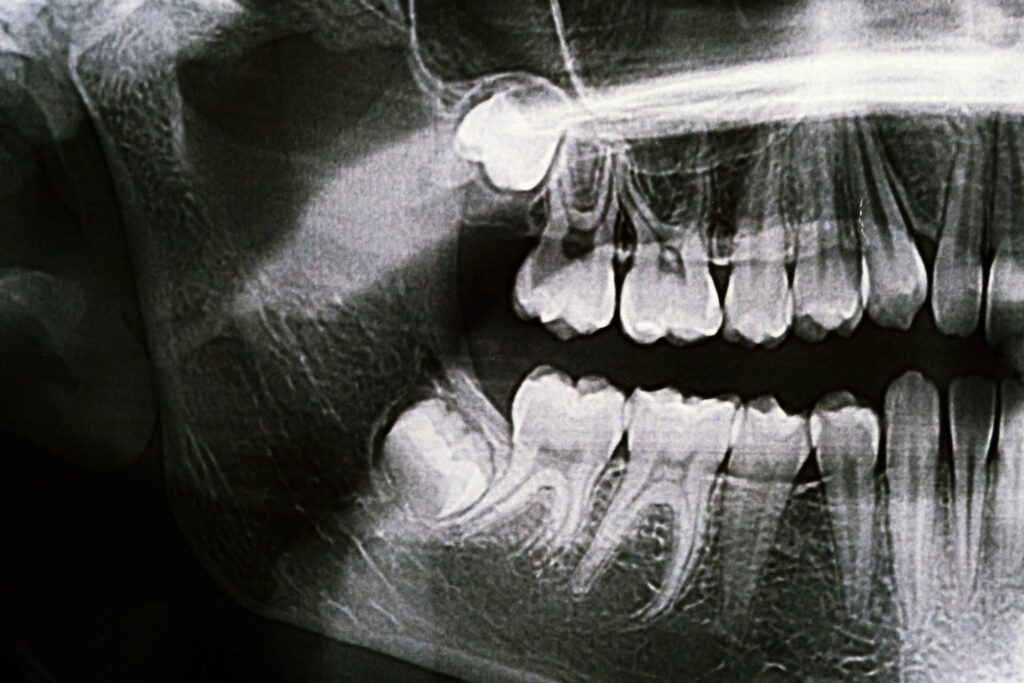 Dentist in Plainfield